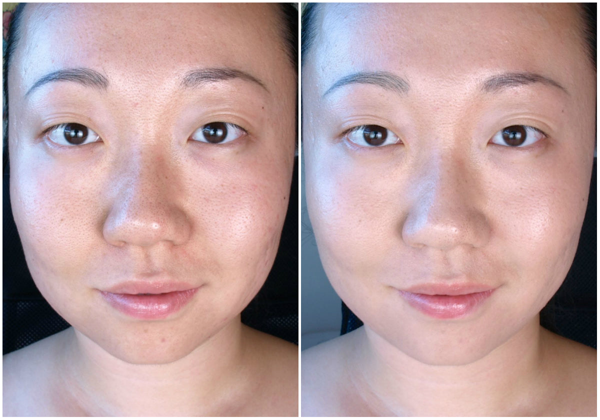 Clinique Acne Solutions BB Cream Broad Spectrum SPF 40 (30ml) – Matte BB Cream for Oily & Acne-Prone Skin