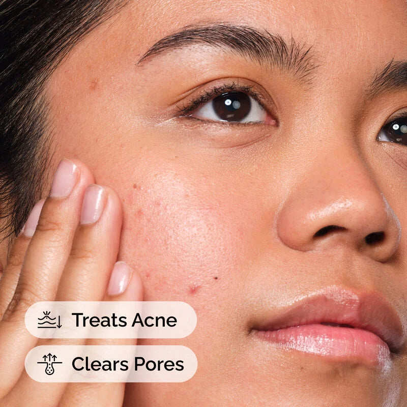 The Ordinary Salicylic Acid 2 Percent Solution Acne Treatment Liquid Serum 30ml