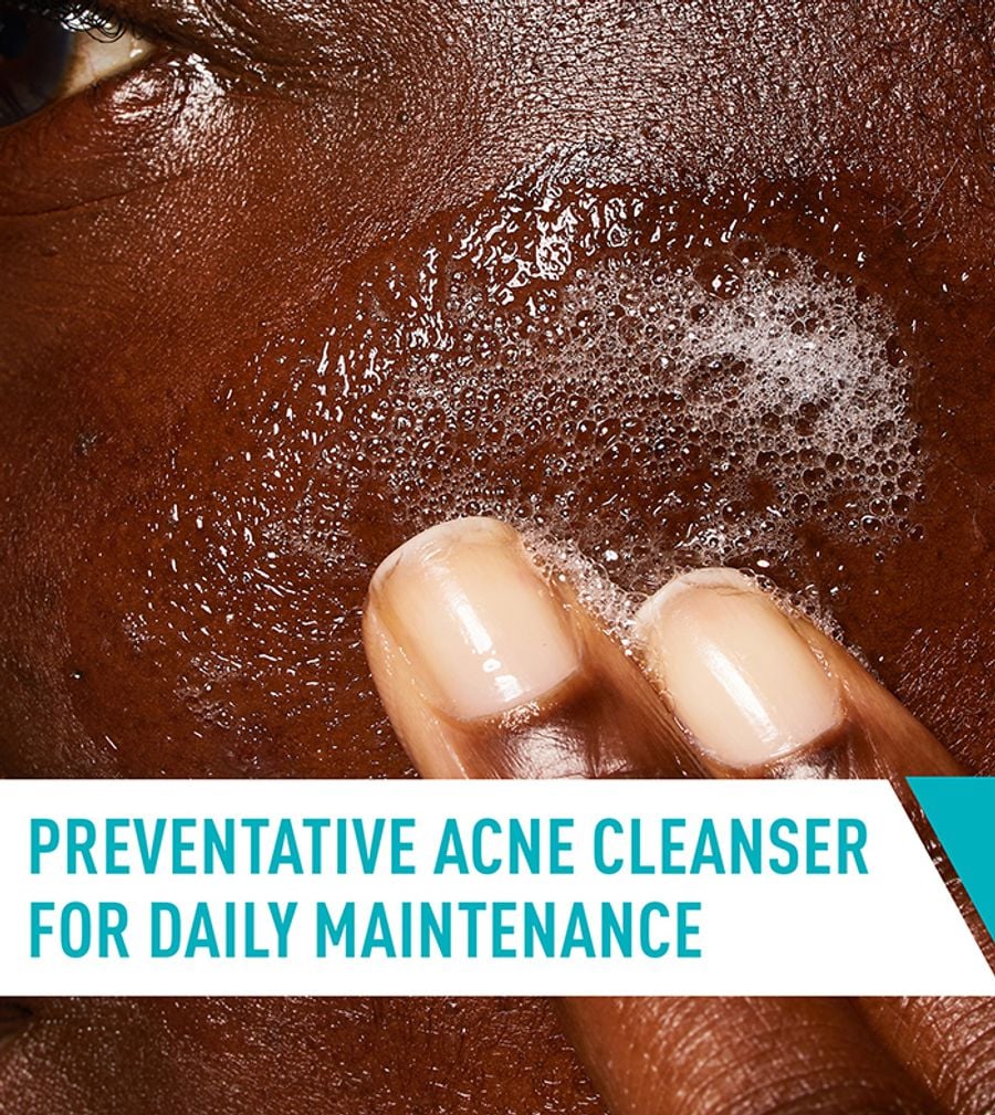 CeraVe Acne Control Cleanser 473ml | Salicylic Acid Face Wash for Acne-Prone Skin